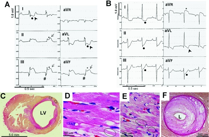 药物诱导心肌缺血实验报告 ——脑垂体后叶素致家兔心肌缺血模型