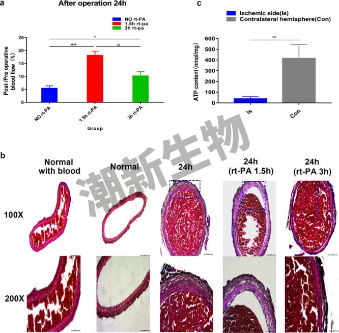 FeCl₃诱导主动脉血栓模型