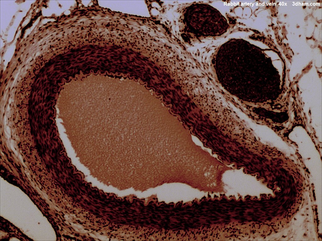 插管损伤兔主动脉形成血栓（Thrombus induced by intubation damage of aorta in rabbits）