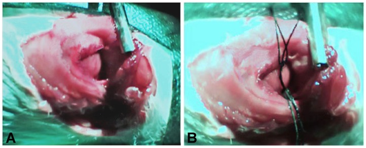 麻醉大鼠冠状动脉结扎诱发心律失常模型
