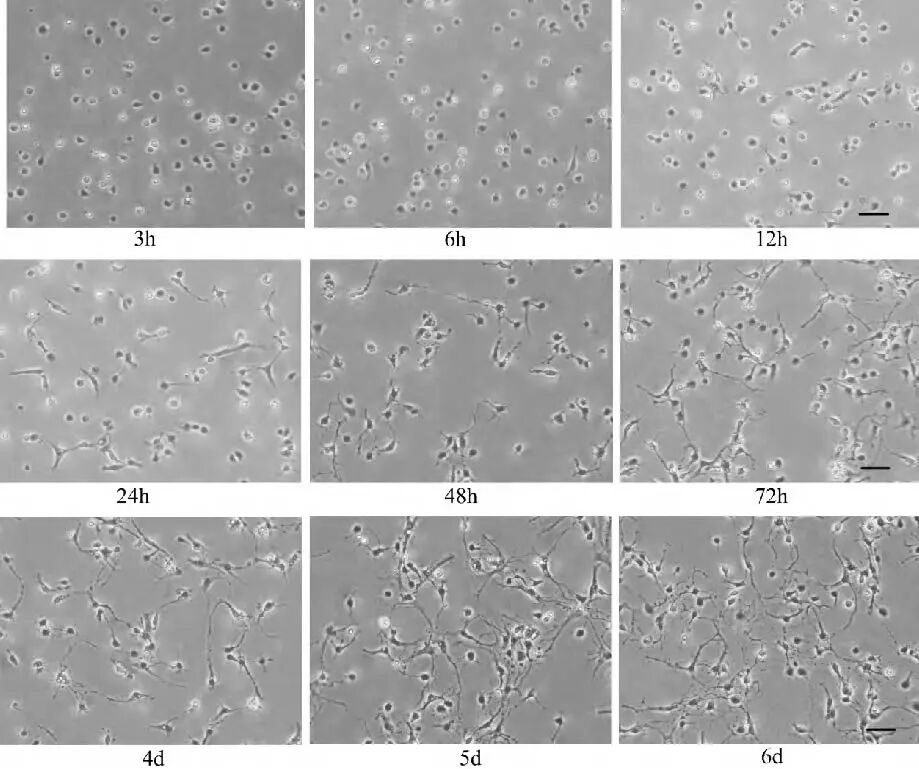 别再踩坑了！新生大鼠海马神经元原代培养方法全攻略！