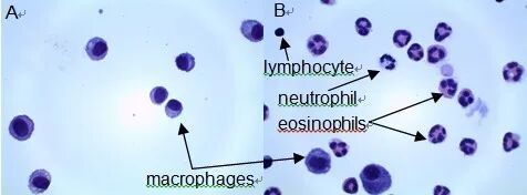 实验解析｜肺泡灌洗获取巨噬细胞的关键步骤