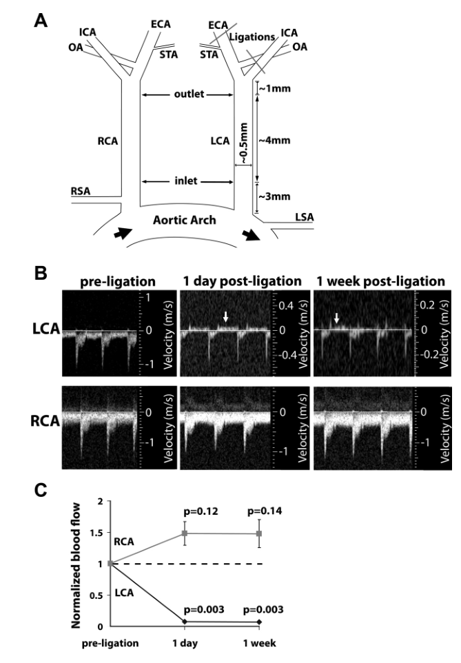 实验干货｜部分左颈总动脉结扎，联合高脂饮食可以快速诱导小鼠动脉粥样硬化模型