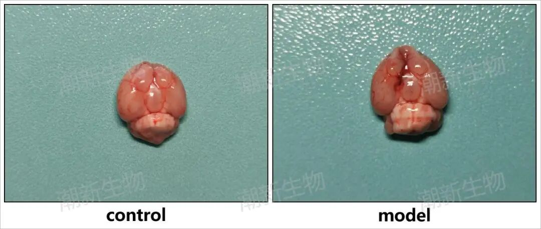 实验解析｜脑血管类疾病动物模型实验步骤分享
